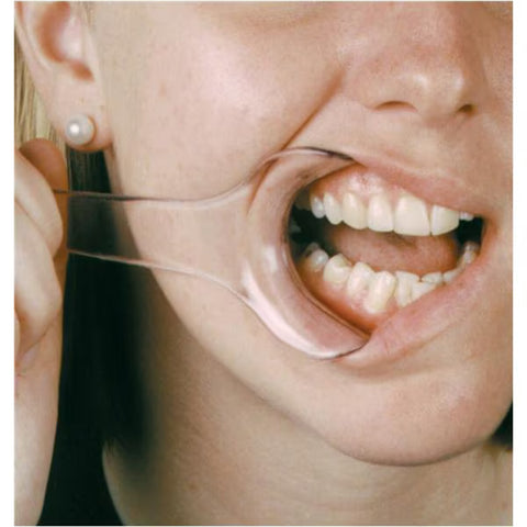 Mouth Opener Tool